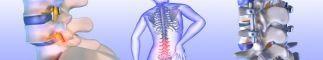 Spondylo-listhesis